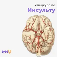 Спецкурс по инсульту