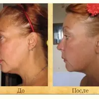 Секреты вечной молодости. ЭкоПластика лица своими руками